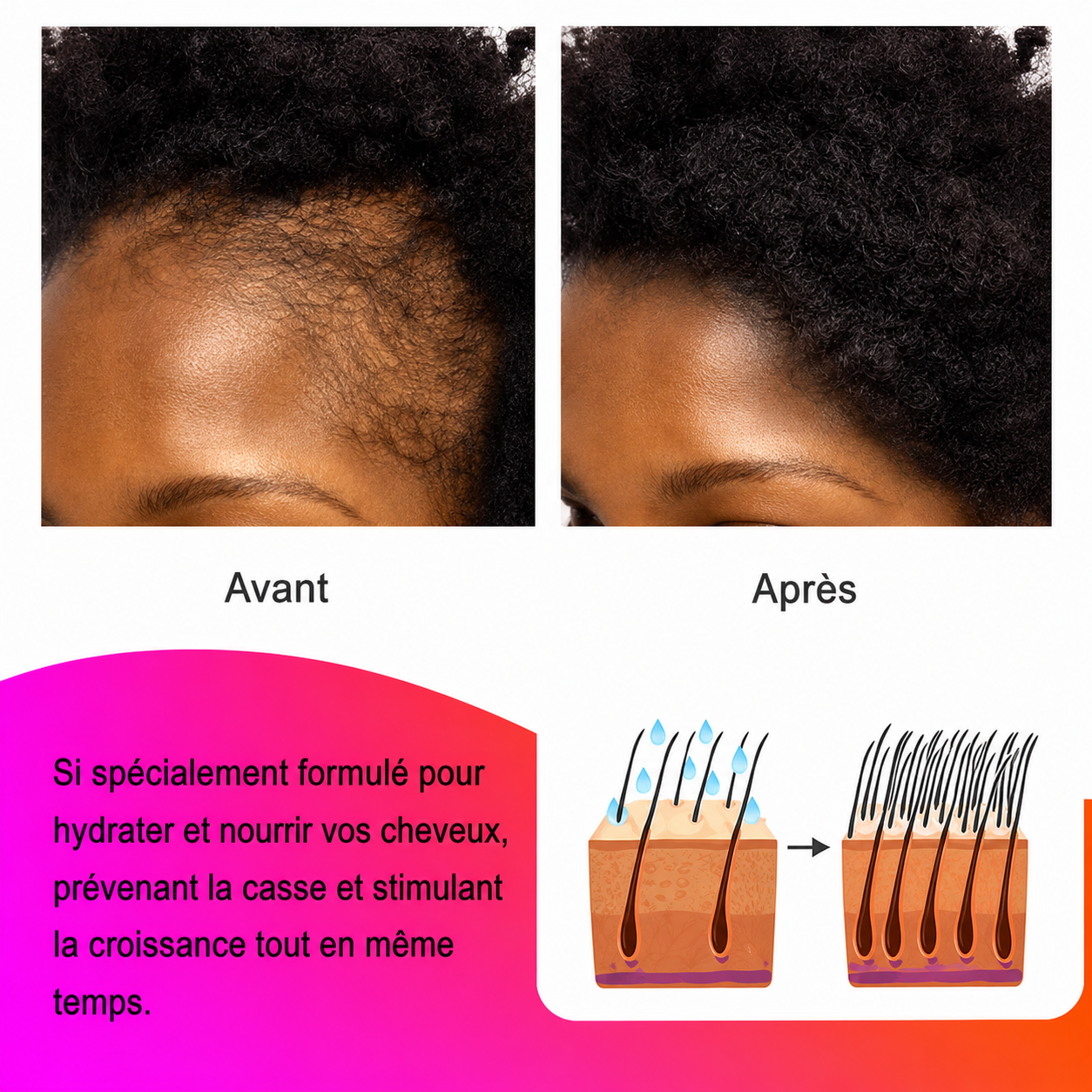 Beurre Capillaire Chebe – Anti-Chute, Croissance & Réparation Intense